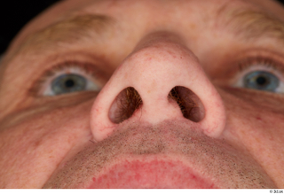 Joseph nose 0003.jpg